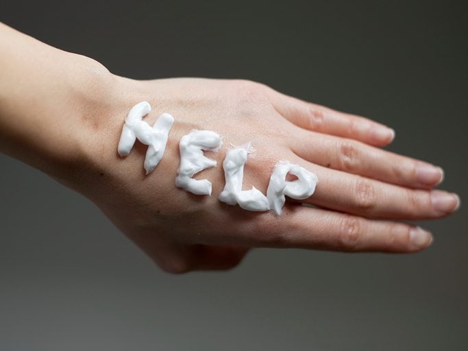 cream on hand with dry skin caused by hard water.